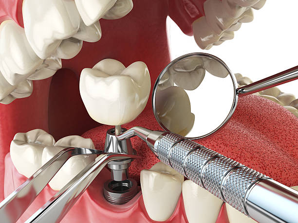 Best Broken or Chipped Tooth Repair in Guilford Center, CT